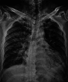 Fig 5