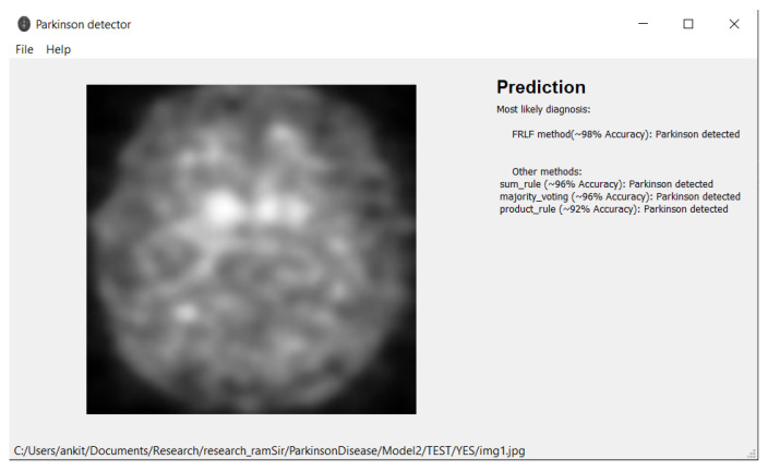 Figure 13