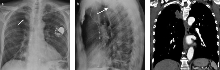 Figure 3. a–c