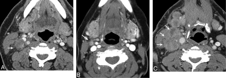 Fig 1.