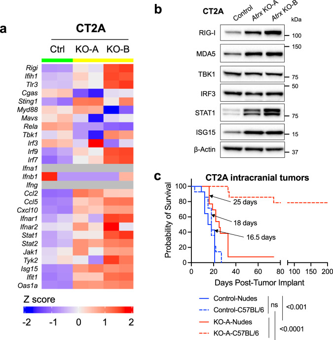 Interplay between ATRX and IDH1 mutations governs innate immune ...