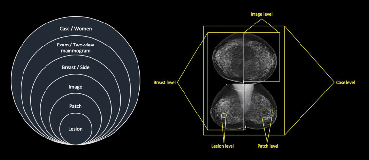 Diagrams show multitime (left) and multiview (right) point data produced with two-dimensional standard view mammography. Data can be analyzed at different levels.