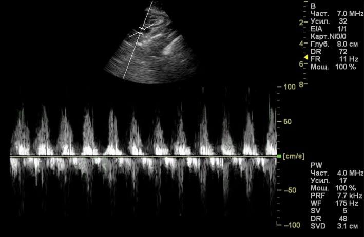 Figure 6