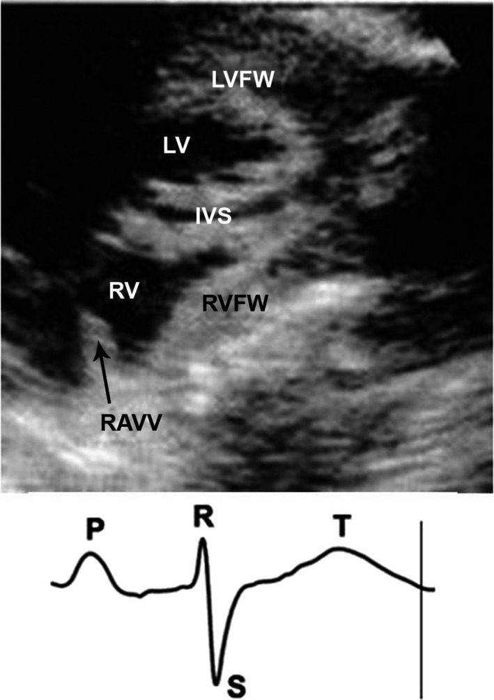 Figure 4