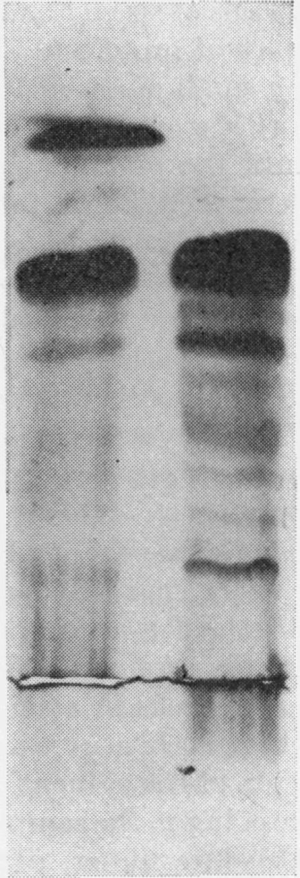 Fig. 2. Gel (b)