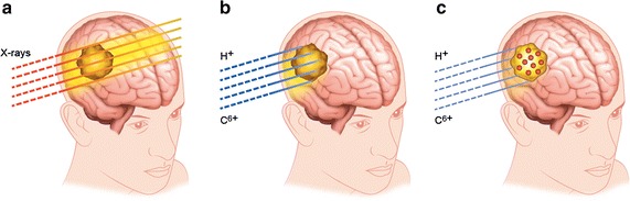 Fig. 1