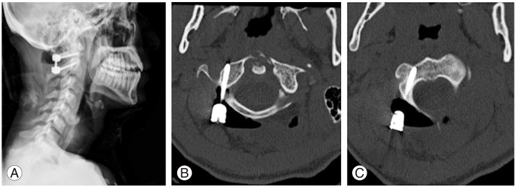 Fig. 3