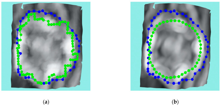 Figure 12