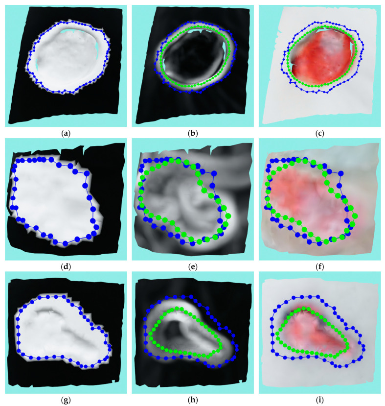 Figure 14