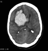 Fig. 6