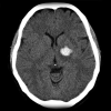 Fig. 5