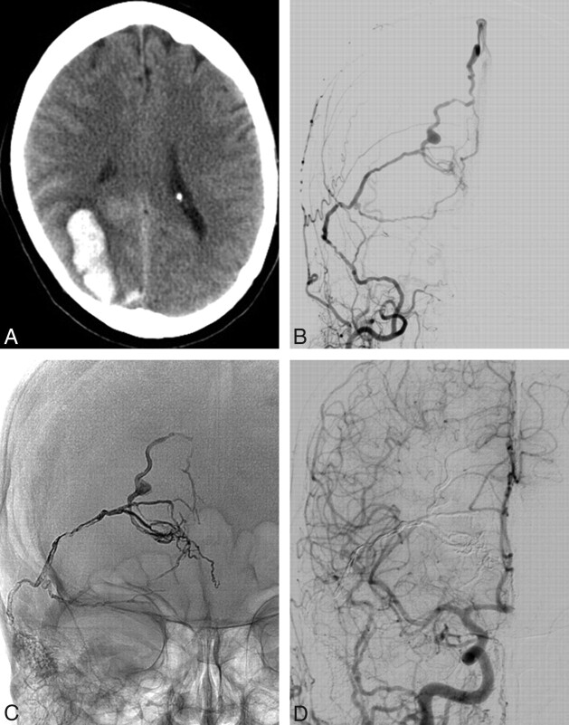 Fig 3.