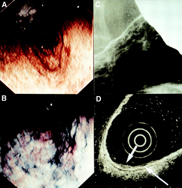 Figure 1  