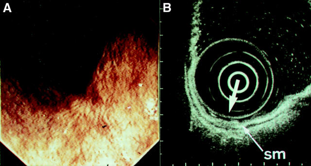 Figure 2  