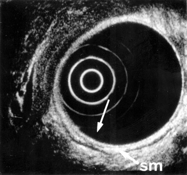 Figure 3  