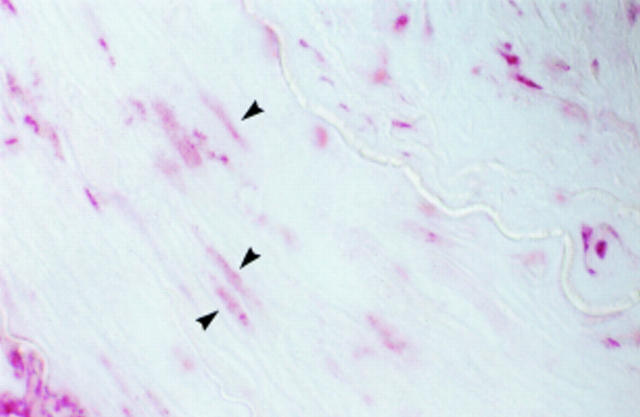 Figure 3  