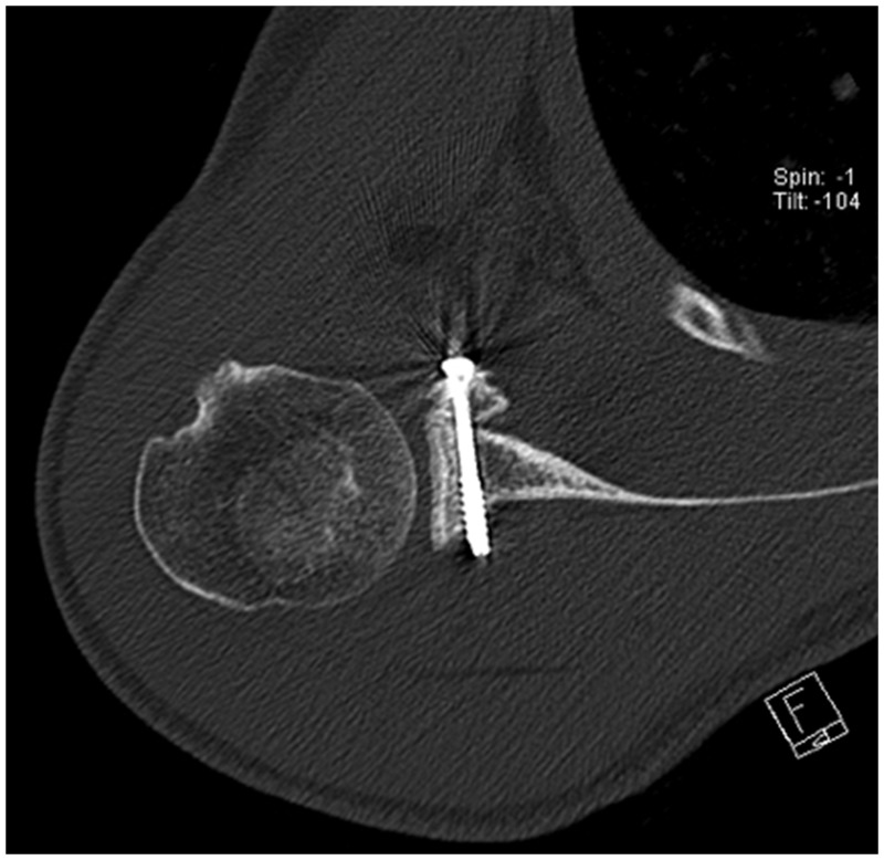 Figure 11.