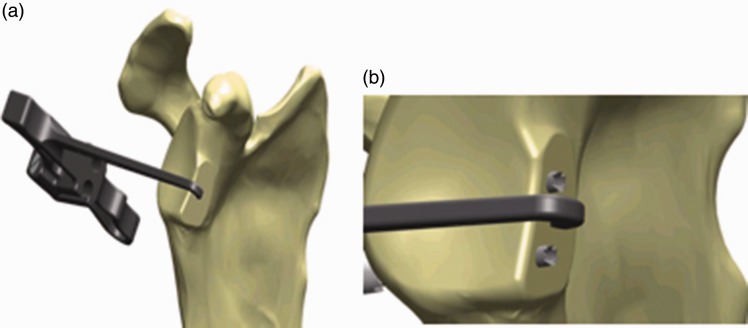 Figure 2.