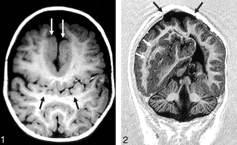 Fig 1.