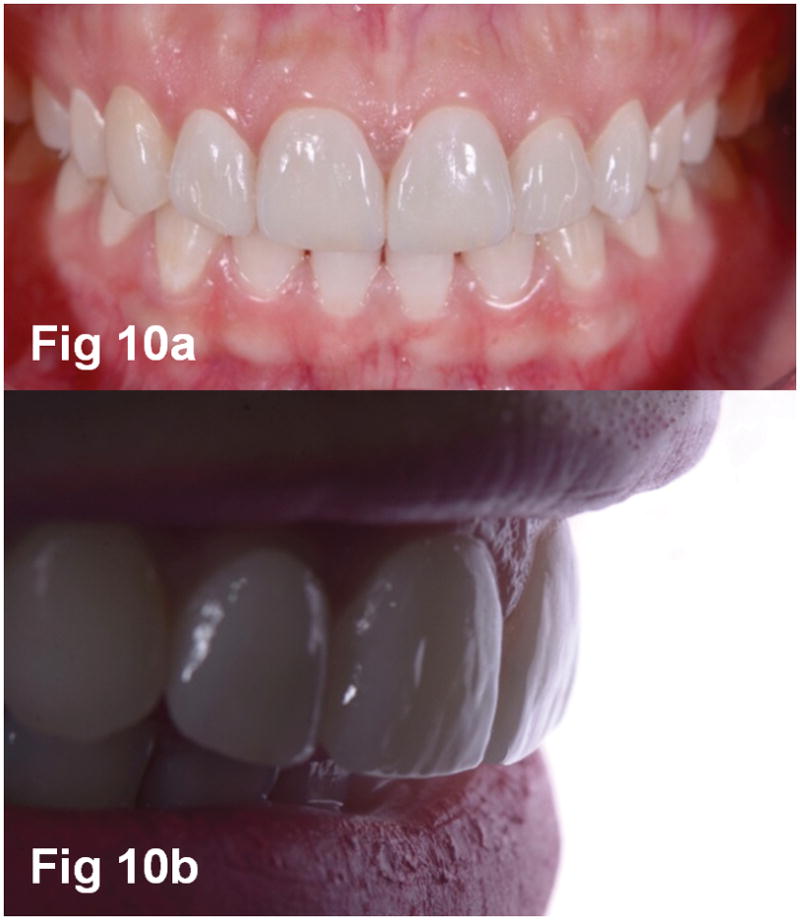 Figures 10a–b