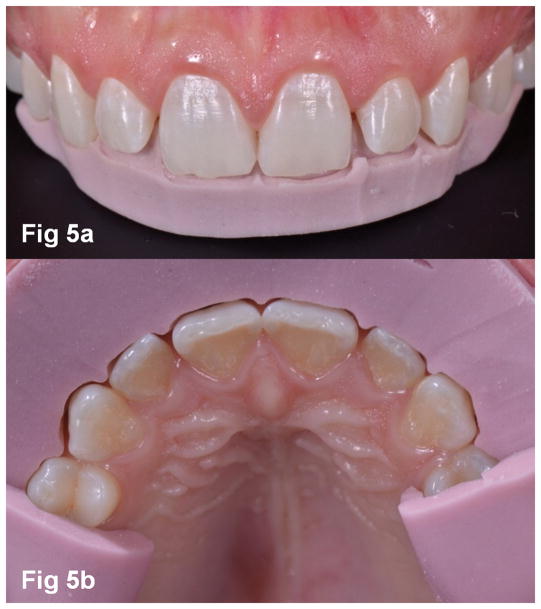 Figures 5a–b