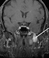 Figure 13.