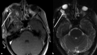Figure 15.