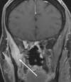 Figure 18.