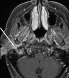 Figure 14.