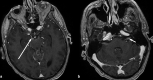 Figure 16.