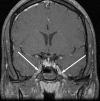 Figure 12.