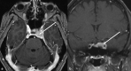 Figure 17.