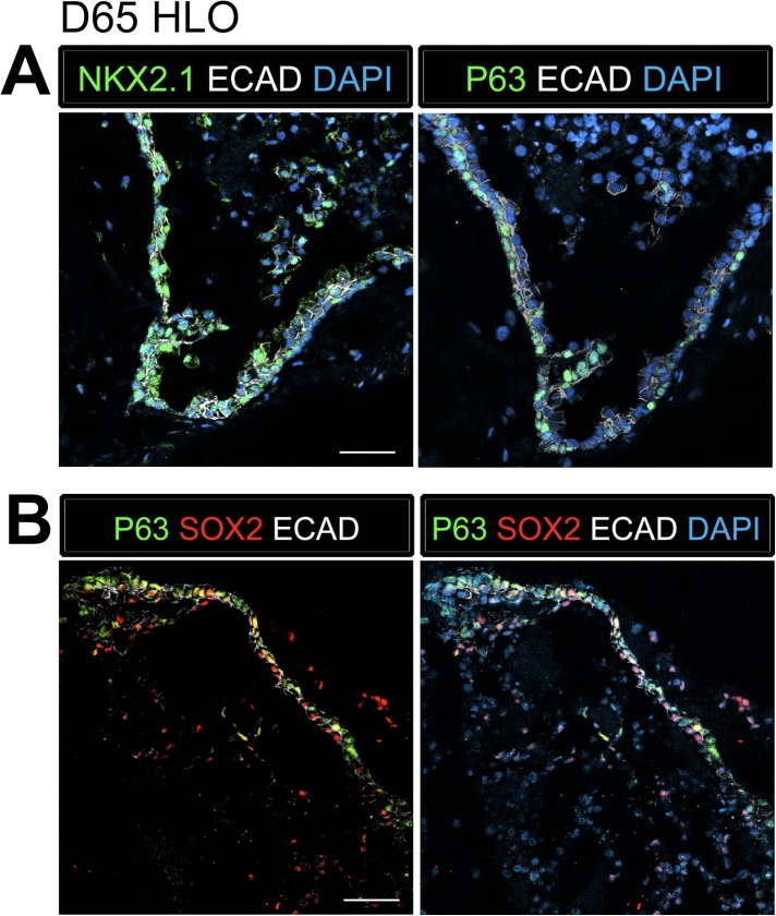 Figure 4—figure supplement 2.