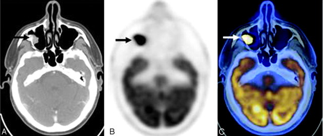 Fig 2.