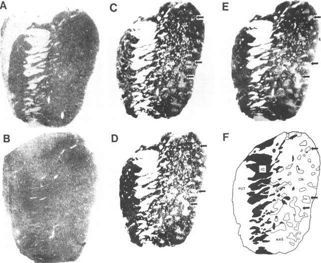 graphic file with name pnas00324-0449-a.jpg