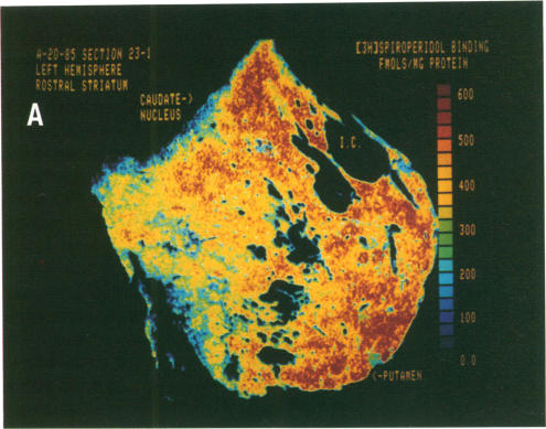 graphic file with name pnas00324-0447-a.jpg