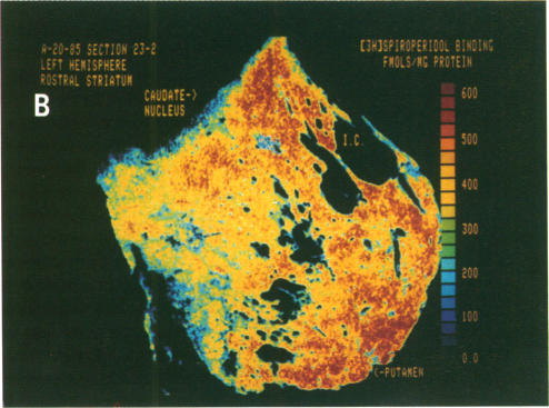 graphic file with name pnas00324-0447-b.jpg