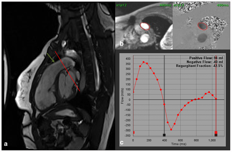 Fig. 4