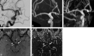 Fig 3.