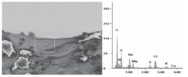 Fig. 15