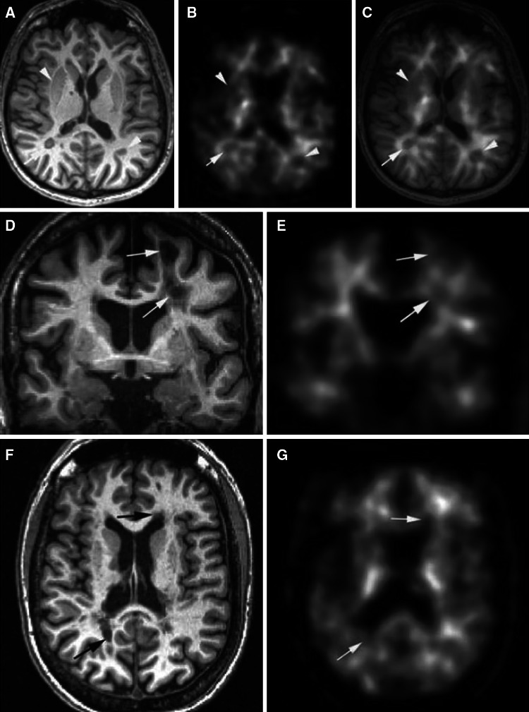 Fig. 6