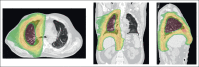 FIG 2.