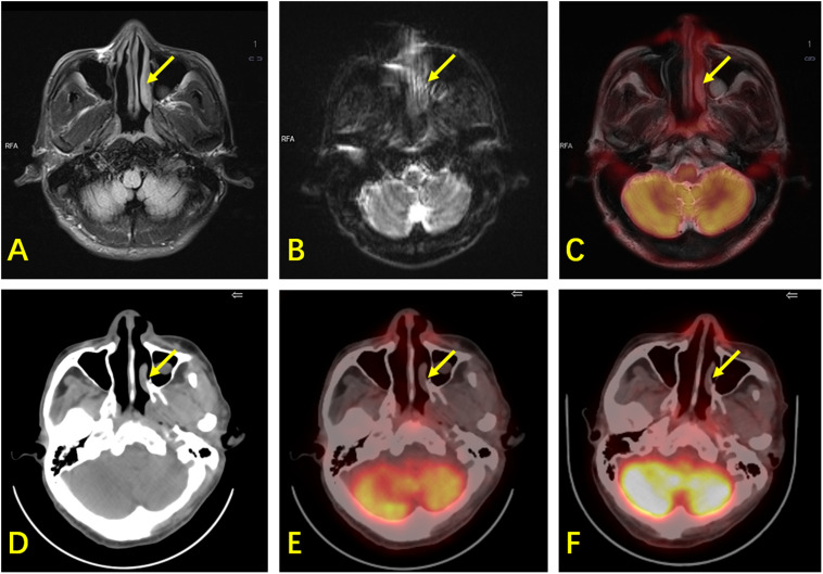 FIGURE 3