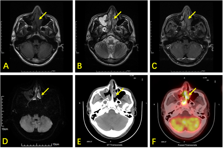 FIGURE 1