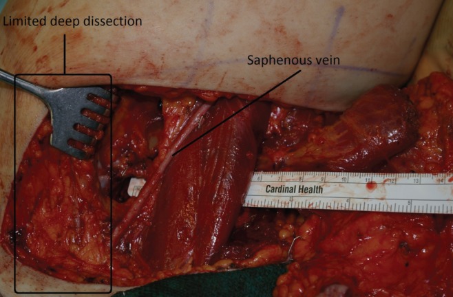 Figure 4)