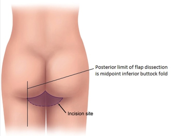 Figure 2)