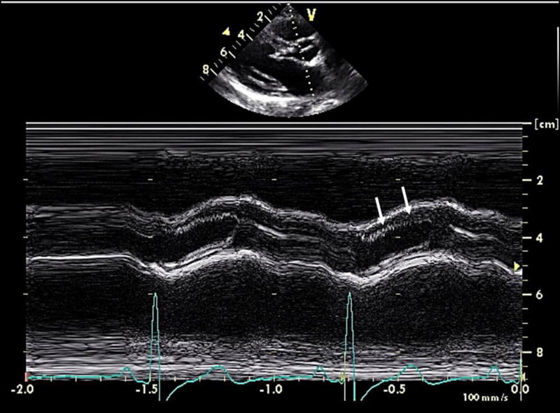 FIGURE 4