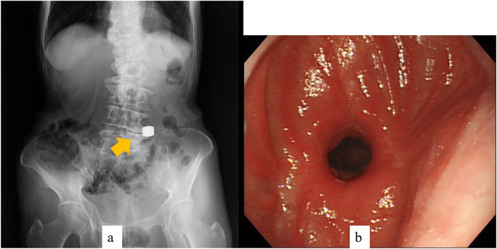 Fig. 6