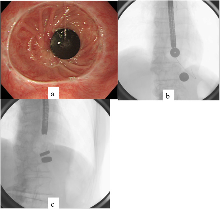 Fig. 4