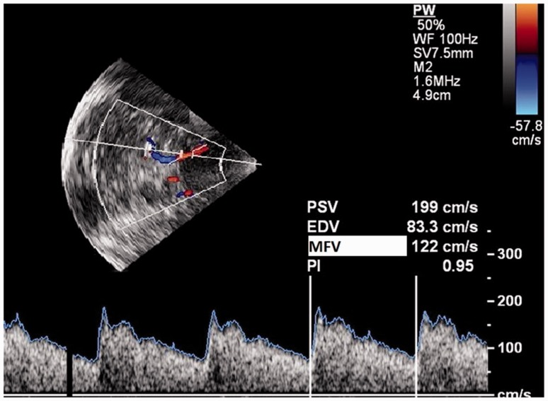 Figure 2.